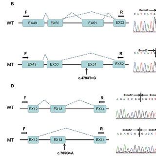 | Minigene assay analysis of two variants in COL4A3: c.4793T > G and ...
