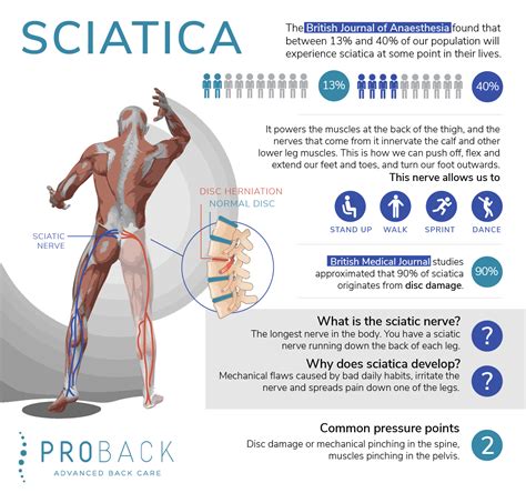 What Is Sciatica Sciatica Diagnosis And Treatment At Proback In London