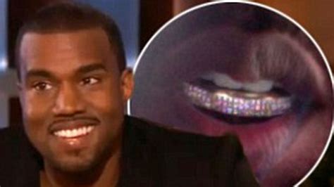 Kanye West Teeth 2025 Elly Noelle