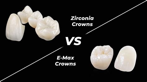 E Max Crowns Vs Zirconium Crowns DMC DENTAL SERVICES