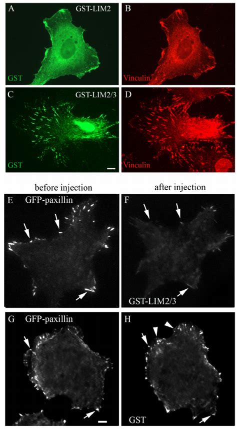 Lim Displaces Full Length Gfp Paxillin From Focal Adhesions