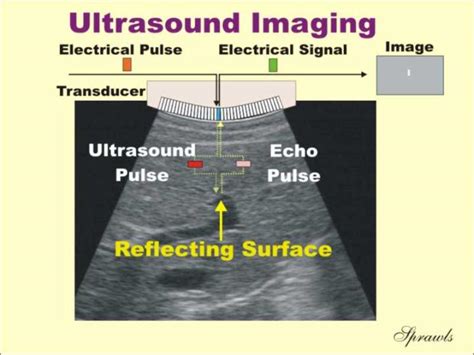 My Life Ultrasound Production And Interactions