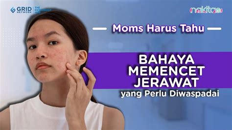 Bahaya Memencet Jerawat Yang Perlu Diwaspadai YouTube