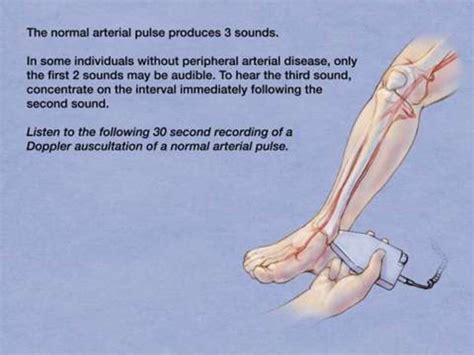 Posterior Tibial Artery Ankle