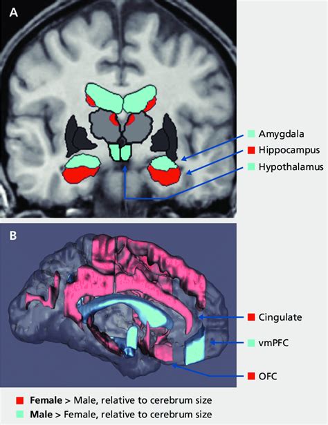 Sexually Dimorphic Subcortical A And Cortical B Regions In Stress Download Scientific