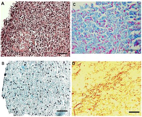 Chondrogenic Differentiation Of Atscs Pellet Culture Stained With A