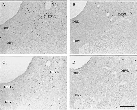 Photomicrographs Of Coronal Sections Of The Medial Level Of The Dr