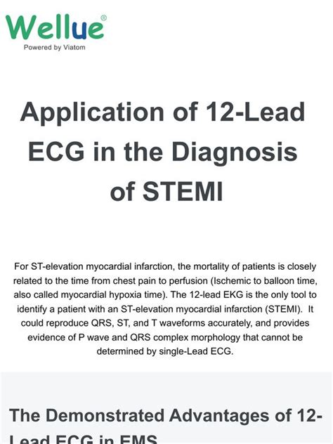 Viatom Technology Co Ltd Application Of 12 Lead Ecg In The