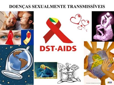 Doenças Sexualmente Transmissivel Ppt