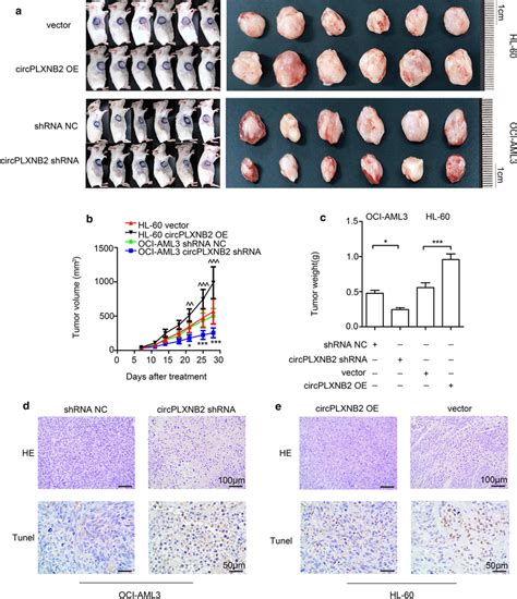 CircPLXNB2 promoted tumour growth in AML xenograft models. a Images of ...