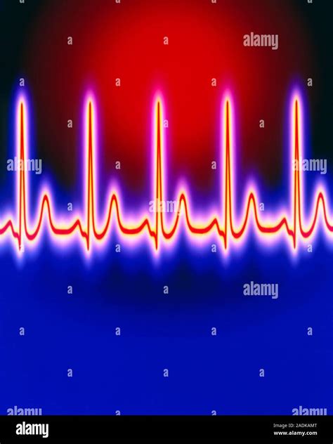 Healthy Ecg Heart Trace Computer Enhanced Image Of An