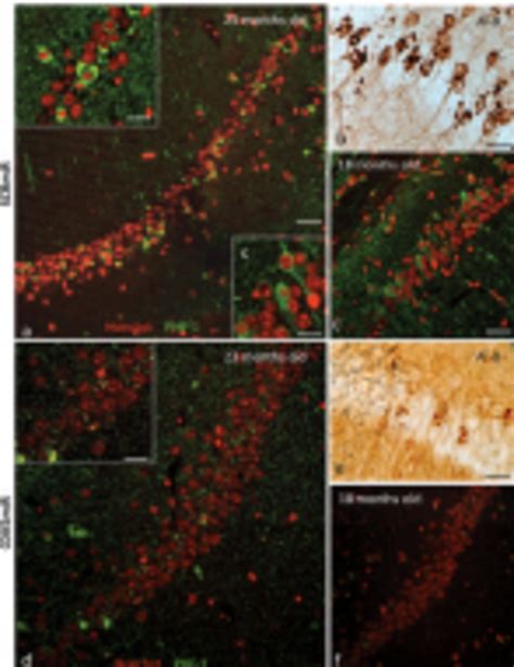 Cdk Mir Decreases Phosphorylated Tau And Neurofibrillary Tangles In