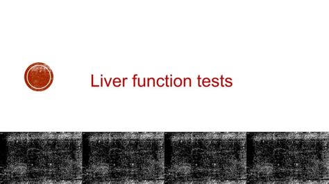 Liver Function Tests Ppt