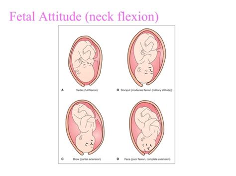 Hp Labor And Delivery Flashcards Quizlet