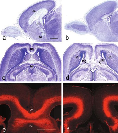 a b Nissl stained parasagittal sections at P0 a GAP 43 ϩ ϩ