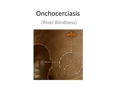 Ppt Onchocerciasis Powerpoint Presentation Free Download Id2282846