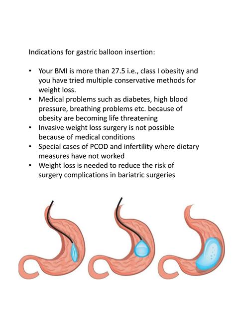 Ppt Gastric Balloon Surgery Procedure And Types Powerpoint