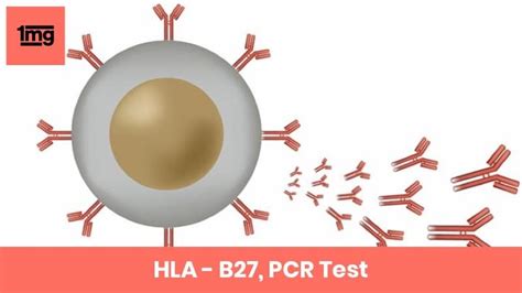 Hla B27 Pcr Purpose And Normal Range Of Results 1mg