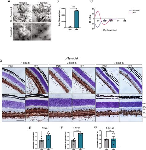 Uptake Of Synuclein Fibrils Following Pffs Intravitreal Injection A