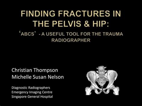 Trauma Image Interpretation Of The Pelvis And Hip Radiographs Using Abcs Ppt