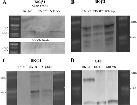 Identification And Localization Of Bk Subunits In The Distal Nephron