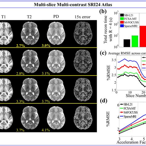 SRI24 Atlas Results A Reconstructed T1 T2 And PD Weighted Images