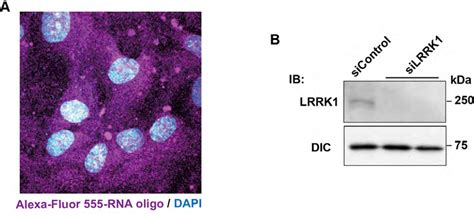 Fig S1 Effect Of Lrrk1 Sirna A Transfection Efficiency Of Rna