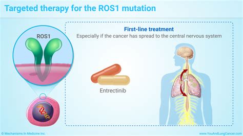 Slide Show - Targeted Therapy in Non-Small Cell Lung Cancer