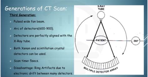 In These Five Generations Of Ct Scans List The