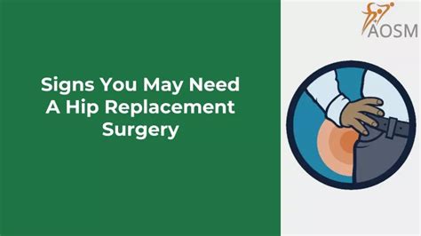 Ppt Signs You May Need A Hip Replacement Surgery Powerpoint