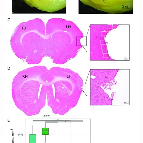 Immunoexpression Of PSD95 In The Rat Brain Cortex 21 Days After The