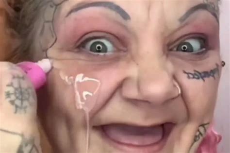 Toothless Nude Model With Gummy Smile Looks Unrecognisable With New Set Of Gnashers Daily Star