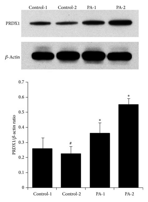 The Mrna And Protein Level Of Prdx Was Determined By Western Blotting