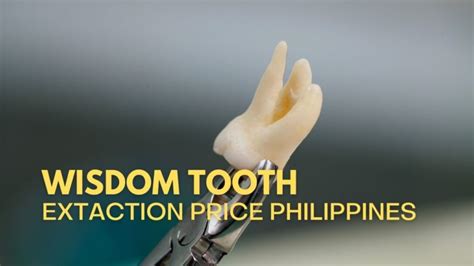 All Dental Care Price List In Philippines 2024