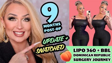 Months Post Op Update Q A Keeping Snatched Lipo Bbl