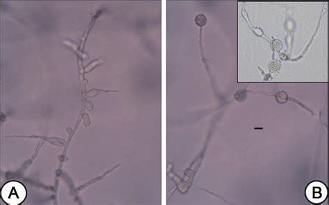 Coralloid Mycelium A And Hyphal Swelling B Of Phytophthora Sp