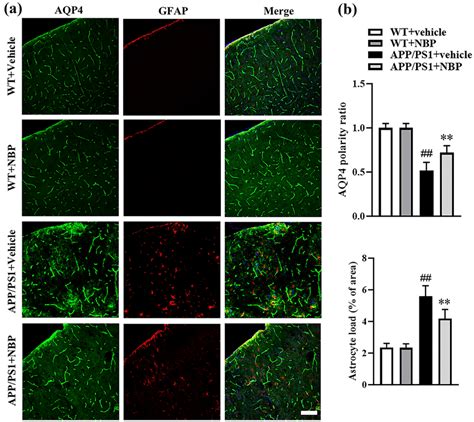 A Increased Expression Of GFAP And AQP4 In The Cortical Cortex Of