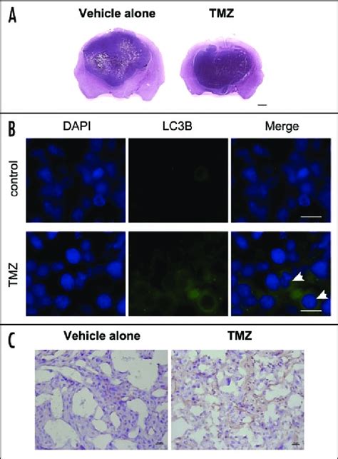 Efficacy of anti-LC3B antibody to detect autophagy in glioblastoma cell ...