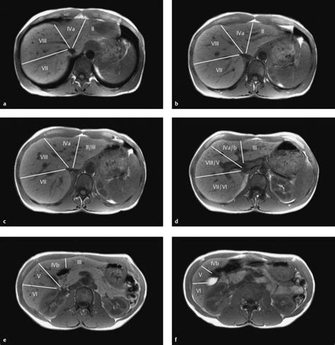 Liver | Radiology Key