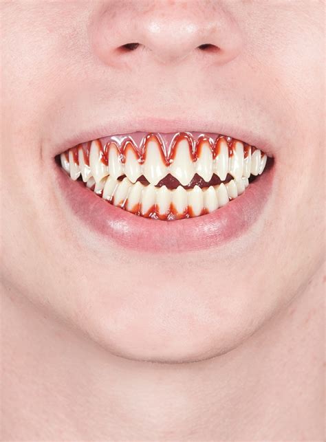 Dental Fx Zähne So Wird Euer Lächeln Furchteinflößend