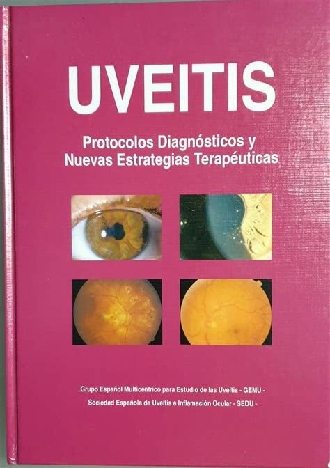 Uveítis Protocolos Diagnósticos y Nuevas Estrategias Terapéuticas VV