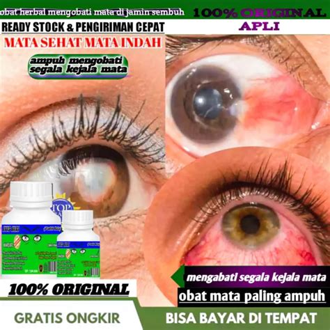 Obat Mata Super Herbal Mata Minus Plus Katarak Silinder Pandang