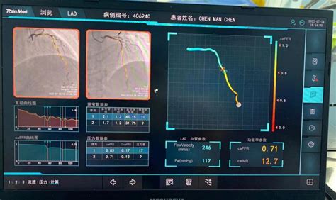 迈入“心”时代丨caffr技术，为冠脉介入手术精准“导航”医疗技术湘南学院附属医院