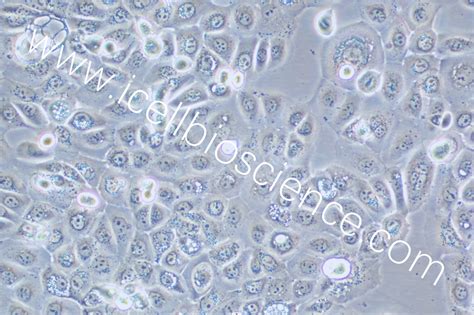 Scc 25 人口腔鳞癌细胞 原代细胞 Str细胞 细胞培养基 镜像绮点生物