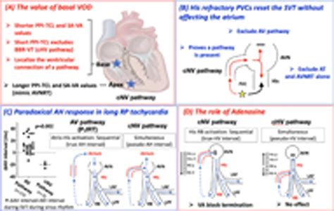 Novel Approaches For The Diagnosis Of Concealed Nodo Ventricular And His Ventricular Pathways