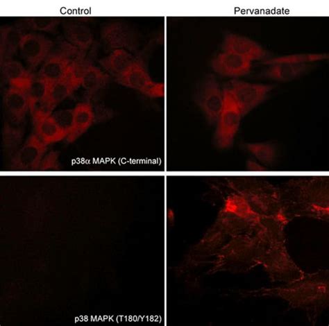 ECM Bioscience P38 MAPK Phospho Regulation Antibody Sampler Kit ECM