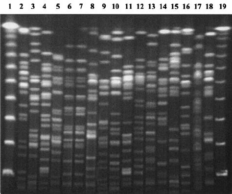 PFGE Patterns Of XbaI Digested Genomic DNA Of The 17 Multiresistant E