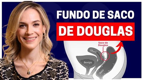 Arquivo De Atividade Sexual E Les O Do Fundo De Saco De Douglas