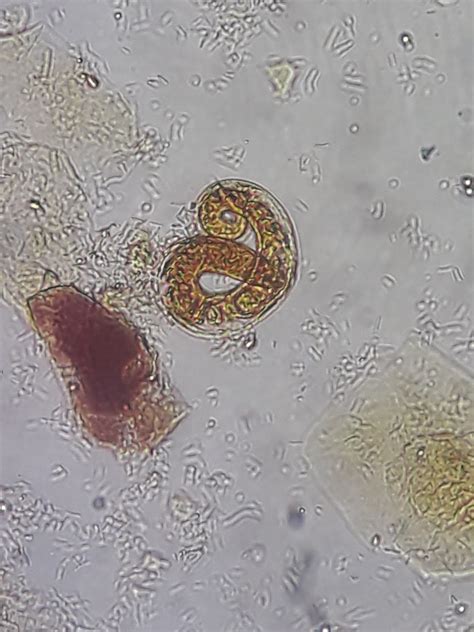 Parasitologia Parásitos En Muestra De Orina