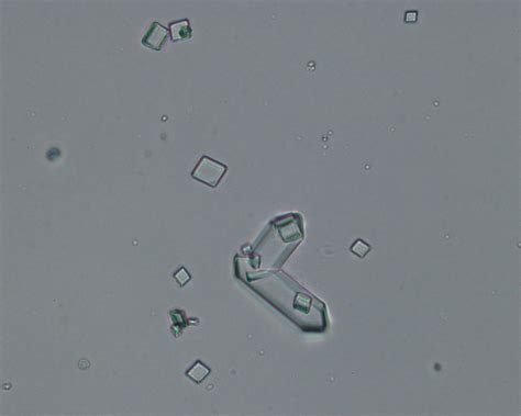 Urine crystals | eClinpath